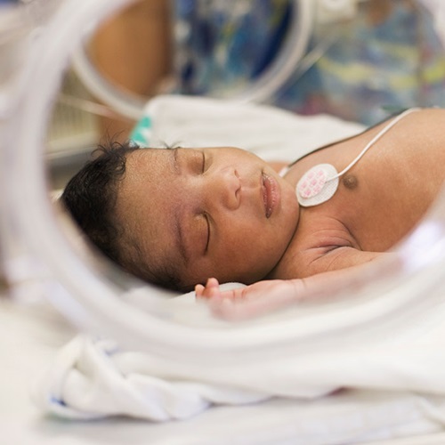 Infant in the NICU.